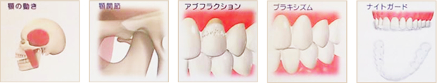 顎関節症や歯ぎしりの治療